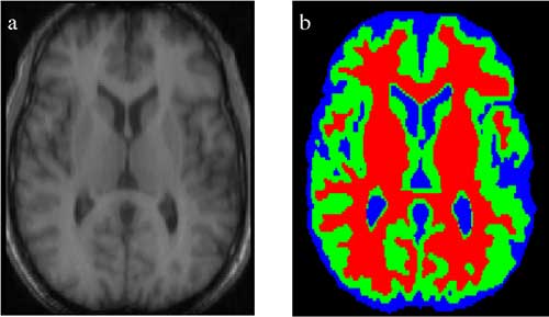 semantic segmentation